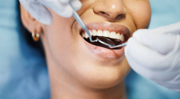Best Emergency Root Canal Treatment in Grandview, TX