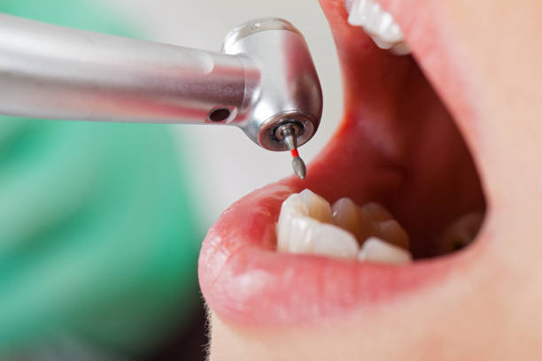 Best Emergency Dentist for Knocked-Out Tooth in Grandview, TX